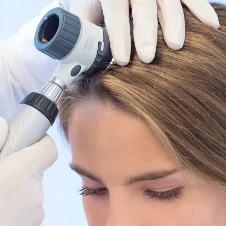 Hormoneller Haarausfall München Blogbild