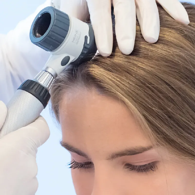 Hormoneller Haarausfall München Blogbild