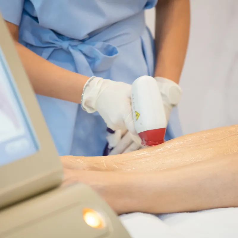 Laserbehandlungen in München bei Dermatologie im Schlosspalais