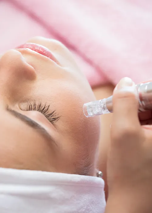 Microneedling in München Website Banner Mobile
